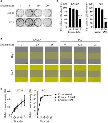 Ceramide Regulates Anti-Tumor Mechanisms of Erianin in Androgen-Sensitive and Castration-Resistant Prostate Cancers